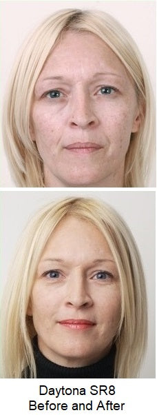 Daytona SR8 Concentrated Skin Rejuvenation Booster