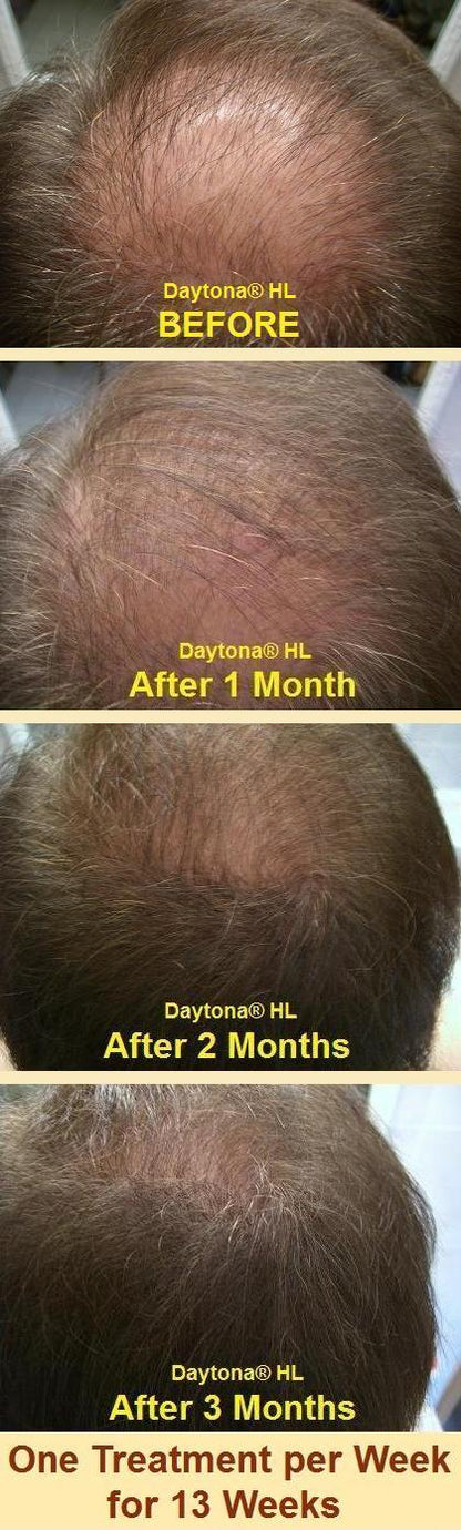 Daytona HL Anti Hair Loss Serum