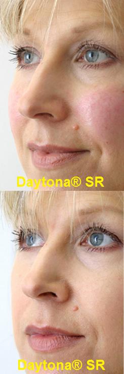 Daytona SR Skin Rejuvenating Serum